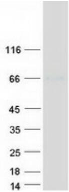 Coomassie blue staining of purified ALB protein.